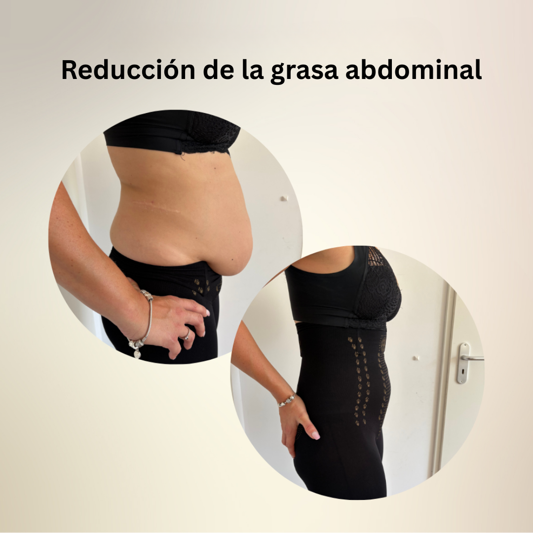 SlimBodyPro™ | Ropa Interior Moldeadora y con Soporte | 1+1 GRATIS